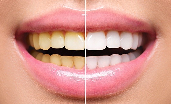 smile design and cosmetic dentistry at smile dental clinic kotte for best dental care 